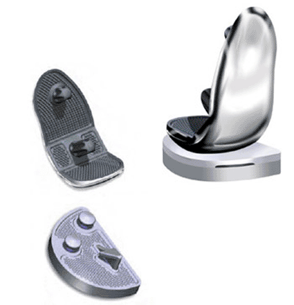 Imagen: El sistema Align 360 Knee, diseñado para permitirle al cirujano discreción en el tratamiento de las etapas de las condiciones degenerativas de rodilla incluyendo enfermedad uni-compartimental, bi-compartimental, y tri-compartimental con un instrumento acoplado y componente hereditario (Foto cortesía de Cardo Medical). Imagen: El sistema Align 360 Knee, diseñado para permitirle al cirujano discreción en el tratamiento de las etapas de las condiciones degenerativas de rodilla incluyendo enfermedad uni-compartimental, bi-compartimental, y tri-compartimental con un instrumento acoplado y componente hereditario (Foto cortesía de Cardo Medical).